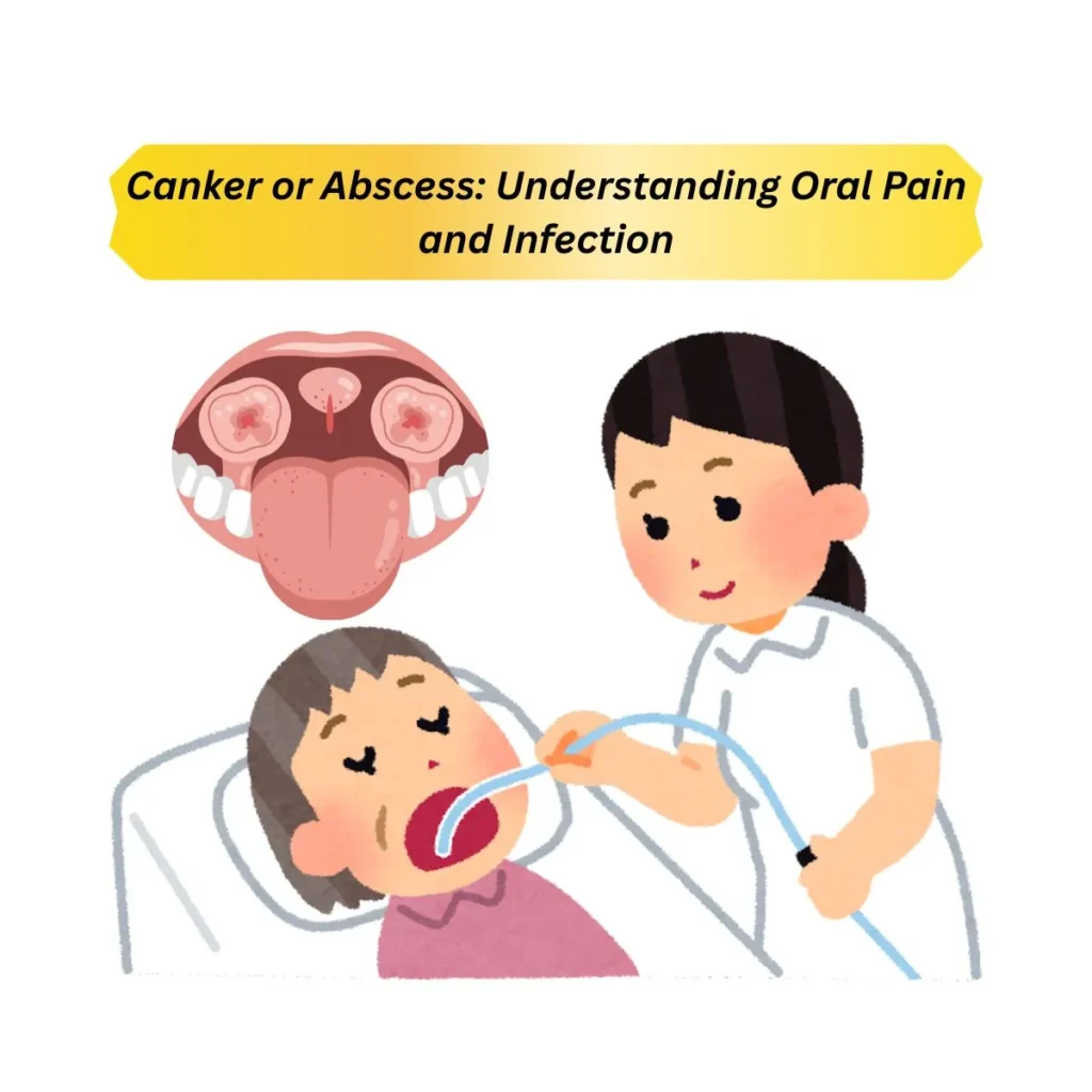 canker-or-abscess