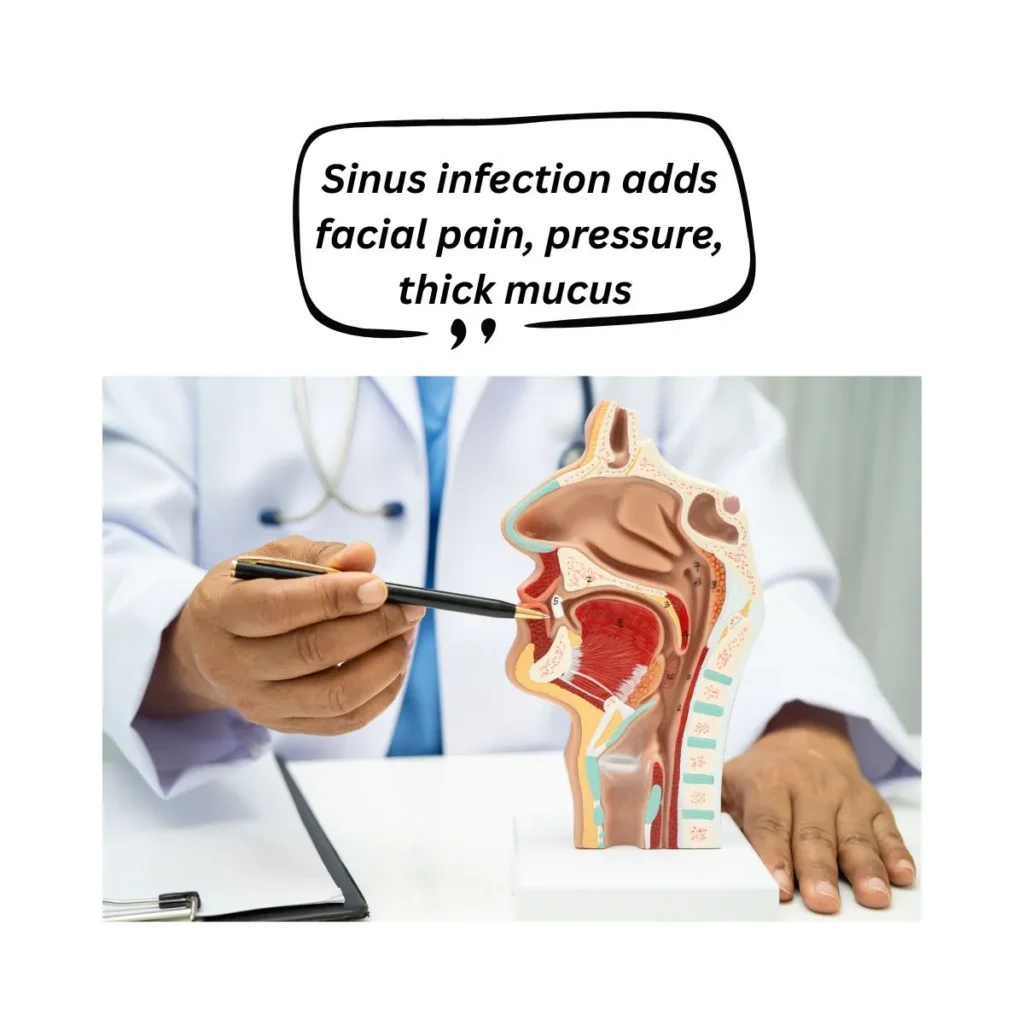 cold-or-sinus-infection-quiz