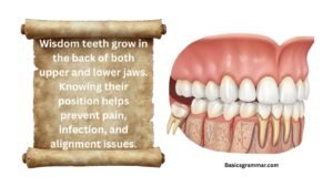 are-wisdom-teeth-on-top-or-bottom