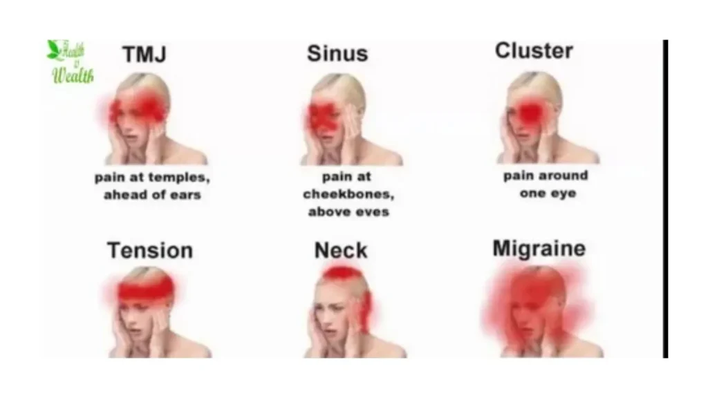 migraine-or-tmj