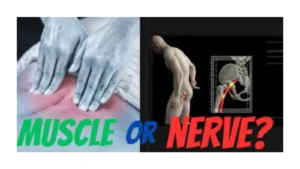 pulled-muscle-or-pinched-nerve