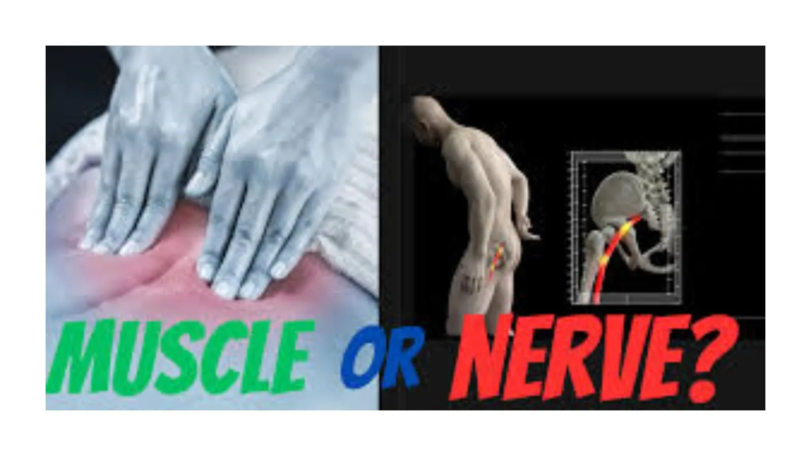 pulled-muscle-or-pinched-nerve