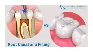 root-filling-or-extraction
