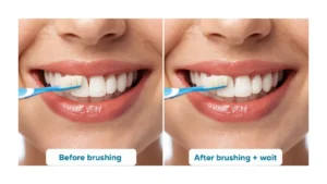 whitening-strips-before-or-after-brushing
